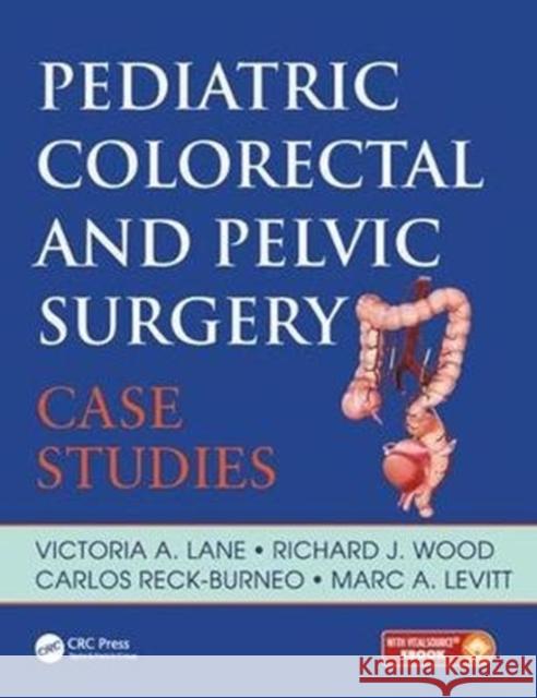 Pediatric Colorectal and Pelvic Surgery: Case Studies Lane, Victoria A.|||Wood, Richard J. (Nationwide Children's Hospital Center for Colorectal and Pelvic Reconstruction, C 9781138715783  - książka