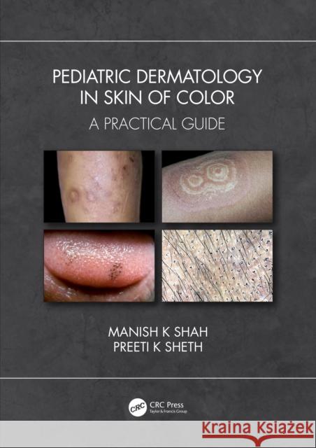 Pediatric Dermatology in Skin of Color: A Practical Guide Shah, Manish K. 9780367760632 CRC Press - książka