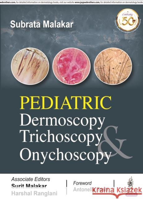 Pediatric Dermoscopy Trichoscopy & Onychoscopy Subrata Malakar 9789389188288 JP Medical Publishers (RJ) - książka