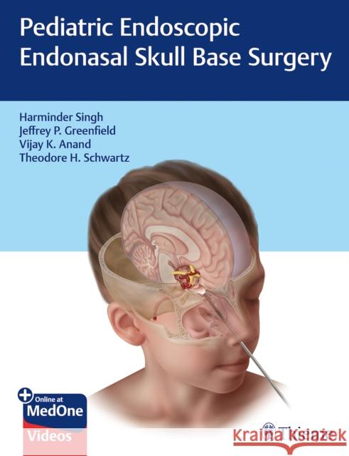 Pediatric Endoscopic Endonasal Skull Base Surgery Harminder Singh Jeffrey Greenfield Vijay Anand 9781626235014 Thieme Medical Publishers - książka