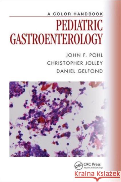 Pediatric Gastroenterology: A Color Handbook Pohl, John F. 9781840762020 Taylor & Francis - książka
