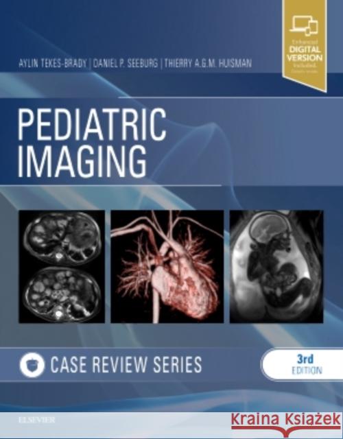 Pediatric Imaging: Case Review Series Aylin Tekes-Brady Daniel P. Seeburg Thierry A. G. M. Huisman 9780323447287 Elsevier - książka