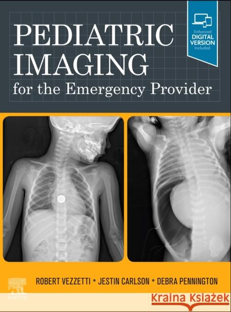 Pediatric Imaging for the Emergency Provider Robert Vezzetti Jestin Carlson Debra Pennington 9780323708494 Elsevier - książka