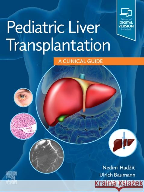 Pediatric Liver Transplantation: A Clinical Guide Nedim Hadzic Ulrich Baumann Val 9780323636711 Elsevier - książka