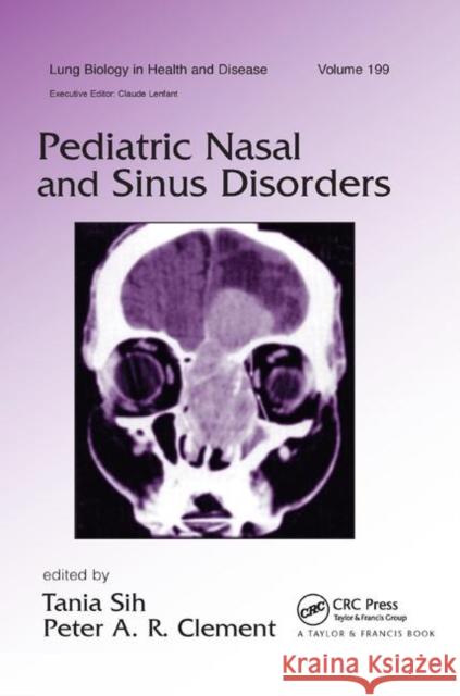 Pediatric Nasal and Sinus Disorders Tania Sih Peter A. R. Clement 9780367393045 CRC Press - książka