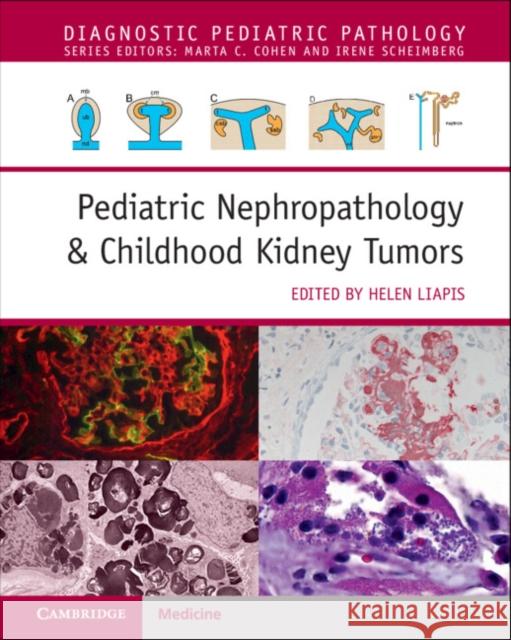 PEDIATRIC NEPHROPATHOLOGY CHILDHOOD KI HELEN LIAPIS 9781108907231 CAMBRIDGE UNIVERSITY PRESS - książka