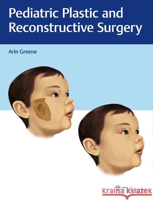 Pediatric Plastic and Reconstructive Surgery Greene, Arin K. 9781626232624 Thieme Medical Publishers - książka