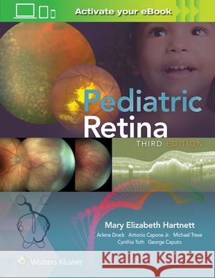 Pediatric Retina Mary Hartnett 9781975110710 LWW - książka