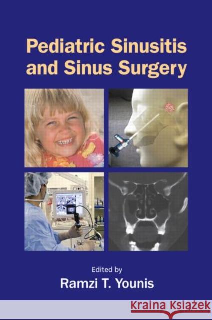 Pediatric Sinusitis and Sinus Surgery Ramzi T. Younis Younis T. Younis Ramzi T. Younis 9780824728816 Informa Healthcare - książka