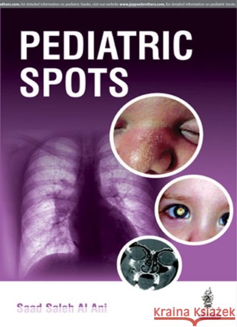 Pediatric Spots Al Ani, Saleh Saad 9789351529316  - książka