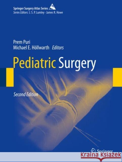 Pediatric Surgery Prem Puri Michael E. Hollwarth 9783662562802 Springer - książka
