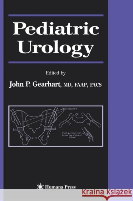 Pediatric Urology John P. Gearhart 9781588291103 Humana Press - książka