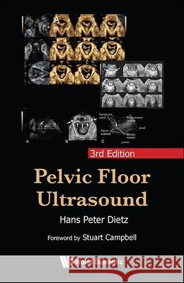 Pelvic Floor Ultrasound: 3rd Edition Hans Peter Dietz 9789819815302 World Scientific Publishing Company - książka