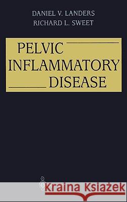 Pelvic Inflammatory Disease D. V. Landers Daniel V. Landers Richard L. Sweet 9780387944623 Springer - książka
