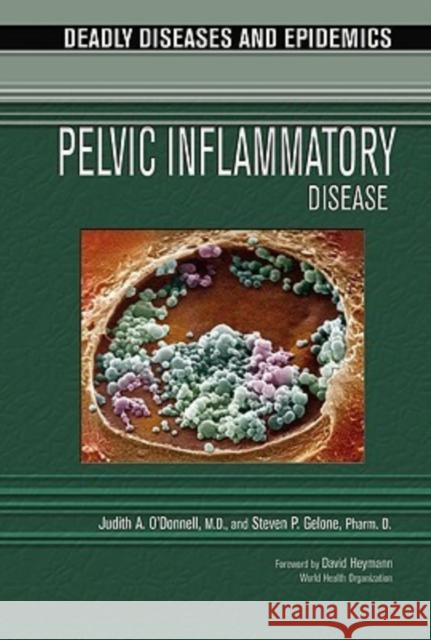 Pelvic Inflammatory Disease Judith O'Donnell Steven Gelone I. Edward Alcamo 9780791085073 Chelsea House Publications - książka