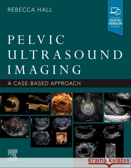 Pelvic Ultrasound Imaging: A Cased-Based Approach Rebecca Hall 9780323789783 Elsevier - książka