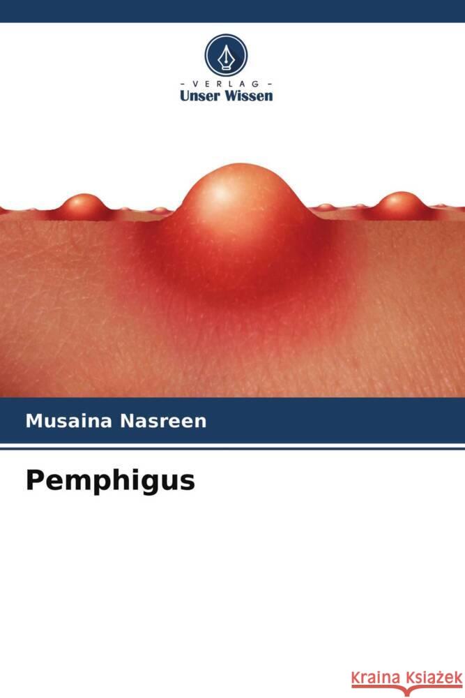 Pemphigus Nasreen, Musaina 9786204693606 Verlag Unser Wissen - książka