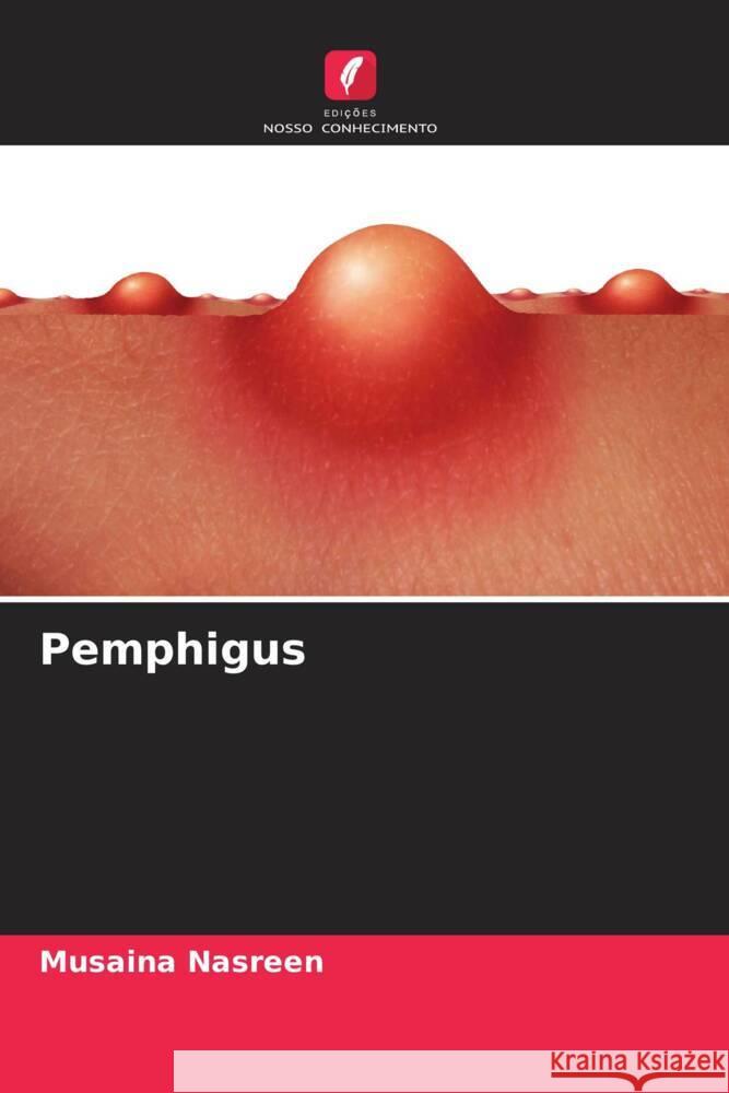 Pemphigus Nasreen, Musaina 9786204693644 Edições Nosso Conhecimento - książka
