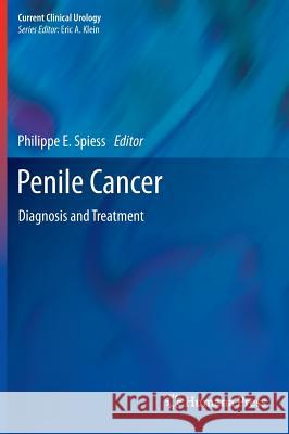 Penile Cancer: Diagnosis and Treatment Philippe E. Spiess 9781627033664 Humana Press - książka