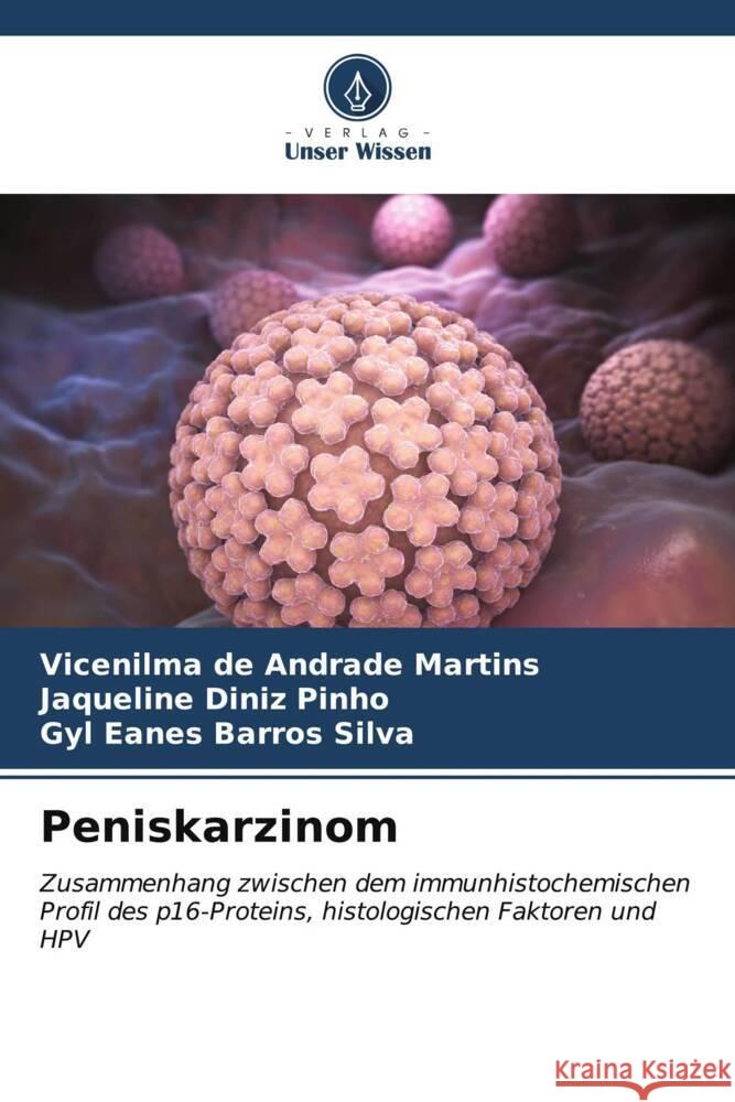 Peniskarzinom de Andrade Martins, Vicenilma, Diniz Pinho, Jaqueline, Barros Silva, Gyl Eanes 9786206554066 Verlag Unser Wissen - książka