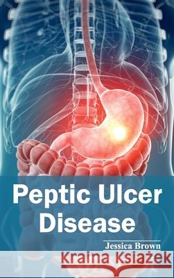 Peptic Ulcer Disease Jessica Brown 9781632423153 Foster Academics - książka