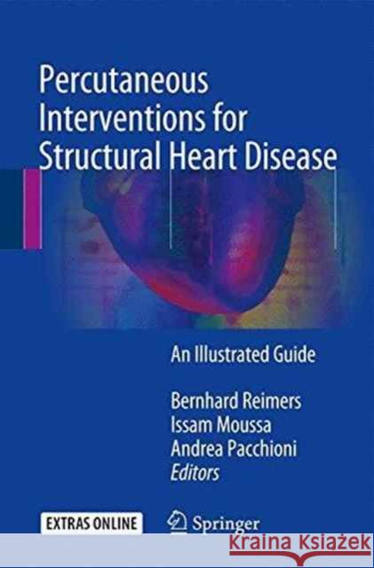 Percutaneous Interventions for Structural Heart Disease: An Illustrated Guide Reimers, Bernhard 9783319437552 Springer - książka