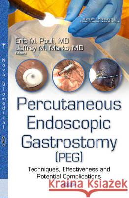 Percutanous Endoscopic Gastrostomy (PEG): Techniques, Effectiveness & Potential Complications Eric Mark Pauli, Jeffrey Marks 9781634856065 Nova Science Publishers Inc - książka