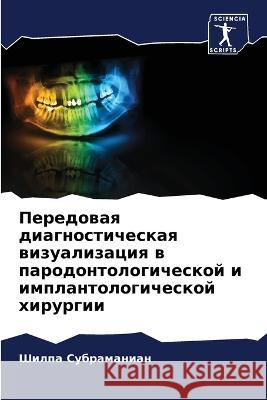 Peredowaq diagnosticheskaq wizualizaciq w parodontologicheskoj i implantologicheskoj hirurgii Subramanian, Shilpa 9786205056769 Sciencia Scripts - książka