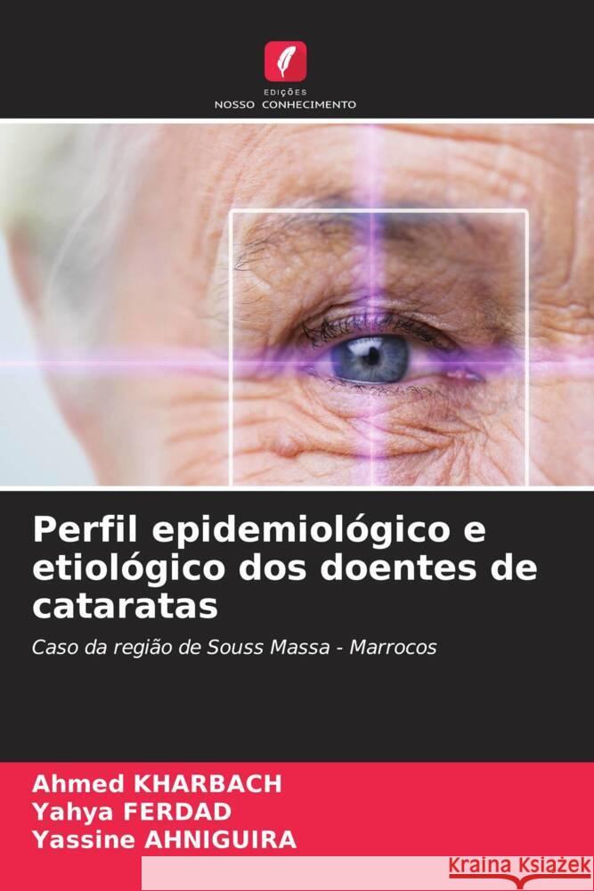 Perfil epidemiológico e etiológico dos doentes de cataratas Kharbach, Ahmed, Ferdad, Yahya, AHNIGUIRA, Yassine 9786204860497 Edições Nosso Conhecimento - książka