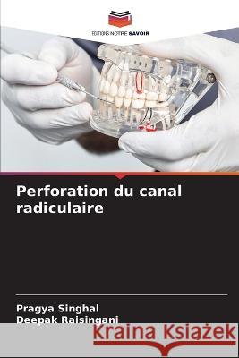 Perforation du canal radiculaire Pragya Singhal Deepak Raisingani 9786205688694 Editions Notre Savoir - książka