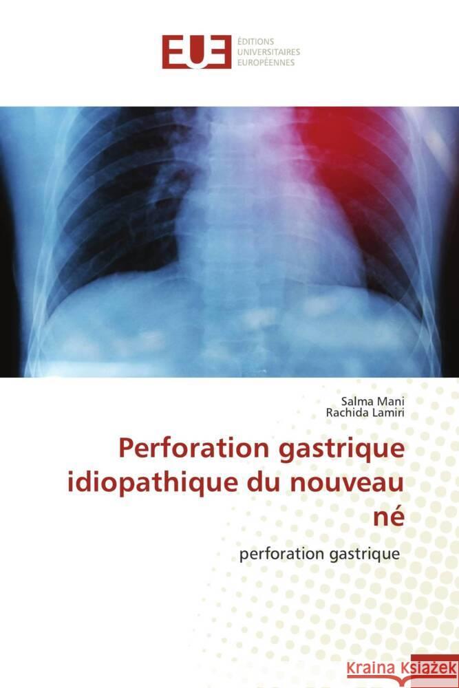 Perforation gastrique idiopathique du nouveau né Mani, Salma, Lamiri, Rachida 9786206708513 Éditions universitaires européennes - książka