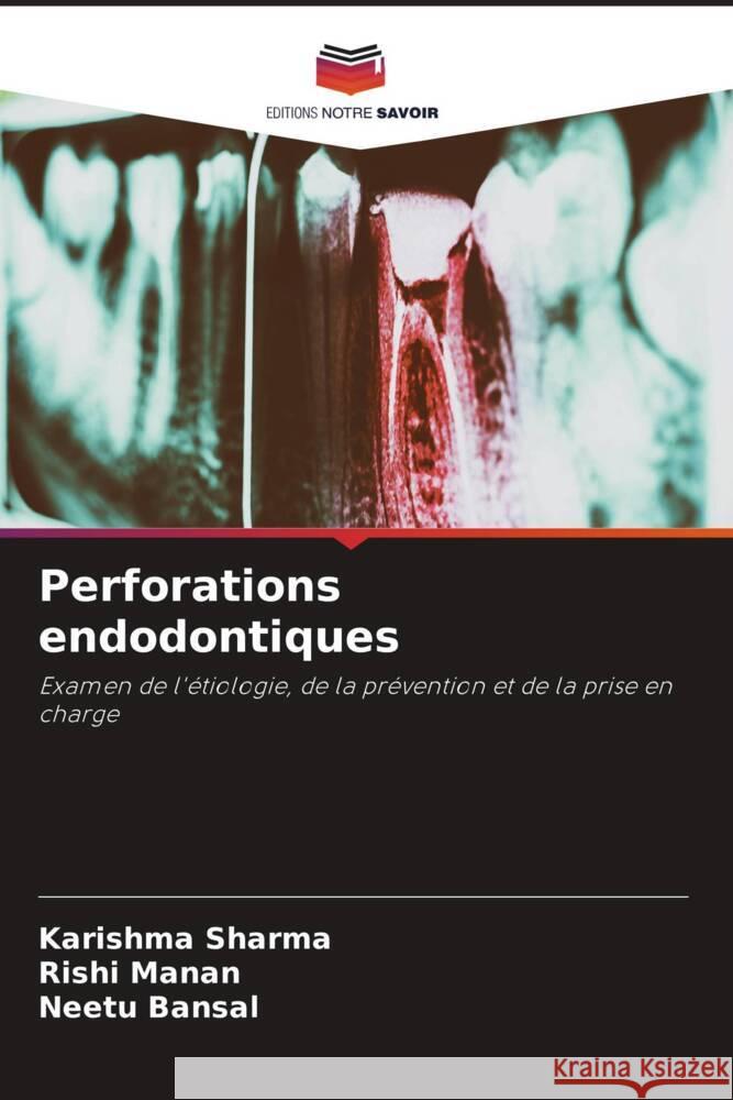 Perforations endodontiques Sharma, Karishma, Manan, Rishi, Bansal, Neetu 9786205486054 Editions Notre Savoir - książka