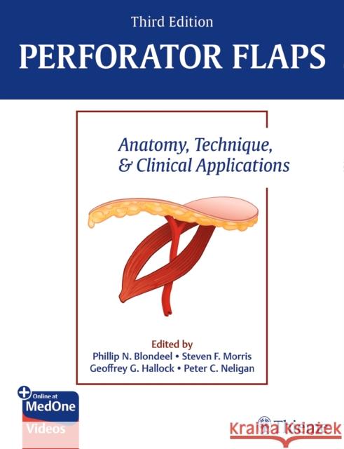 Perforator Flaps: Anatomy, Technique, & Clinical Applications Phillip Blondeel Steven Morris Geoffrey G. Hallock 9781684200726 Thieme Medical Publishers - książka