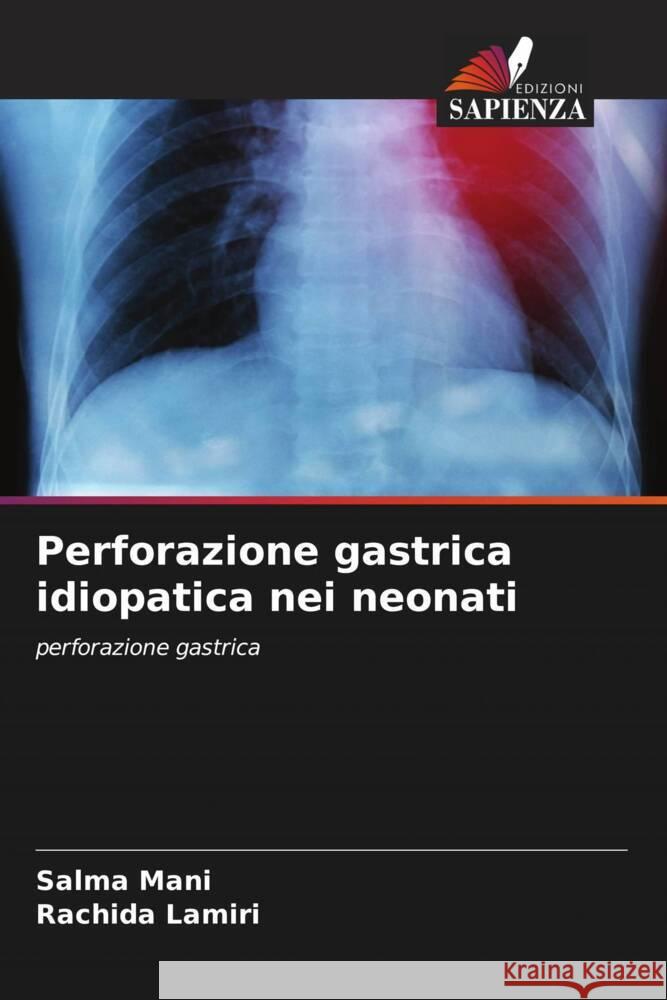 Perforazione gastrica idiopatica nei neonati Salma Mani Rachida Lamiri 9786207402762 Edizioni Sapienza - książka