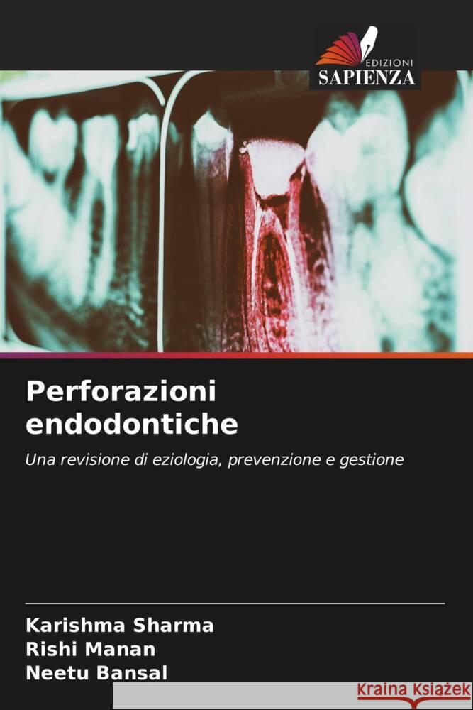 Perforazioni endodontiche Sharma, Karishma, Manan, Rishi, Bansal, Neetu 9786205486061 Edizioni Sapienza - książka