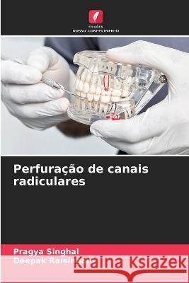 Perfura??o de canais radiculares Pragya Singhal Deepak Raisingani 9786205688724 Edicoes Nosso Conhecimento - książka