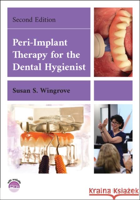 Peri-Implant Therapy for the Dental Hygienist Susan S. Wingrove 9781119766186 John Wiley and Sons Ltd - książka