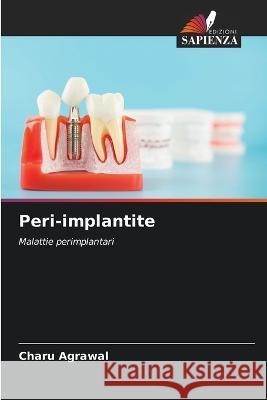 Peri-implantite Charu Agrawal 9786205629871 Edizioni Sapienza - książka