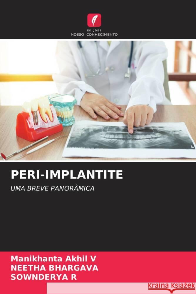 Peri-Implantite Manikhanta Akhi Neetha Bhargava Sownderya R 9786207382934 Edicoes Nosso Conhecimento - książka