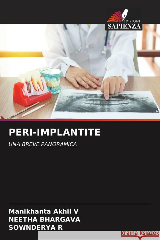 Peri-Implantite Manikhanta Akhi Neetha Bhargava Sownderya R 9786207382958 Edizioni Sapienza - książka