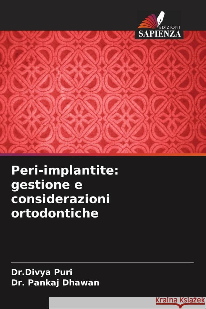 Peri-implantite: gestione e considerazioni ortodontiche Puri, Divya, Dhawan, Pankaj 9786205084809 Edizioni Sapienza - książka