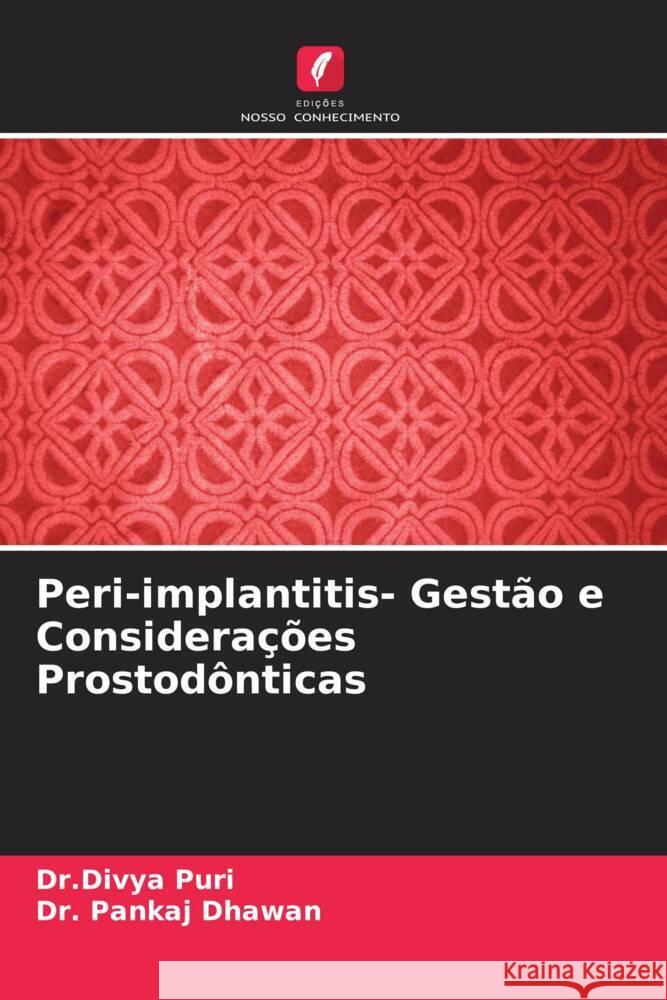 Peri-implantitis- Gestão e Considerações Prostodônticas Puri, Divya, Dhawan, Pankaj 9786205084816 Edições Nosso Conhecimento - książka