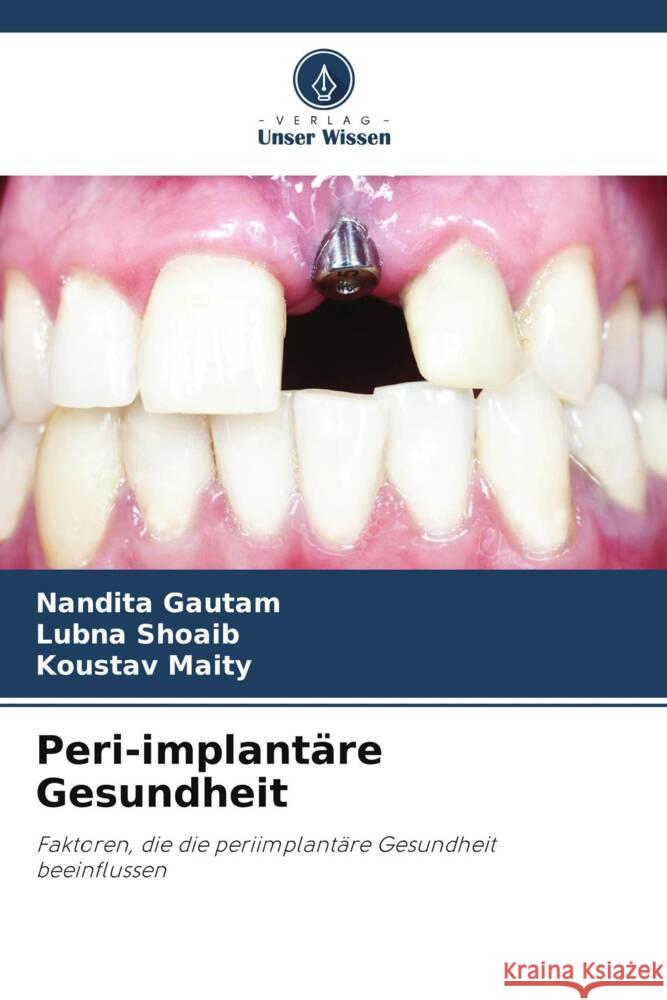 Peri-implantäre Gesundheit Gautam, Nandita, Shoaib, Lubna, Maity, Koustav 9786205051542 Verlag Unser Wissen - książka