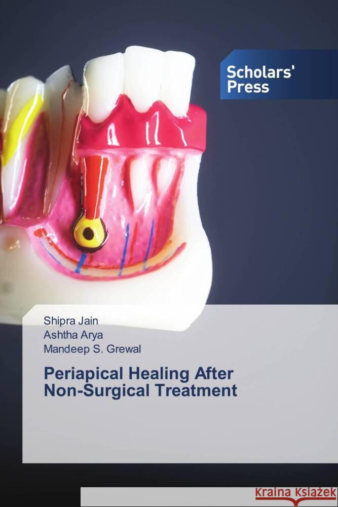 Periapical Healing After Non-Surgical Treatment Jain, Shipra, Arya, Ashtha, Grewal, Mandeep S. 9786206770473 Scholars' Press - książka