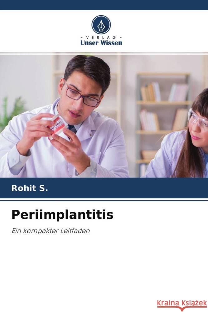 Periimplantitis S., Rohit 9786204249445 Verlag Unser Wissen - książka