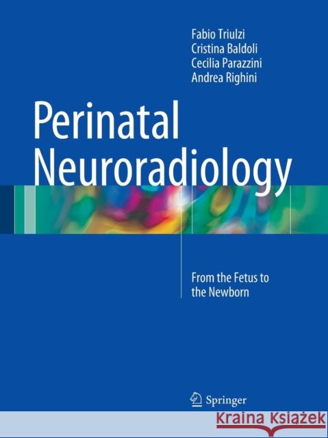 Perinatal Neuroradiology: From the Fetus to the Newborn Triulzi, Fabio 9788847058507 Springer - książka