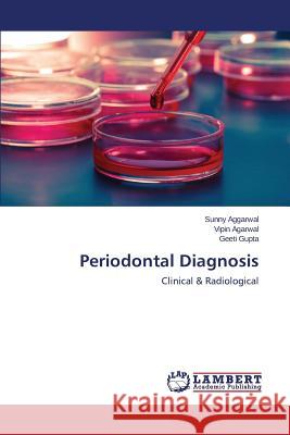 Periodontal Diagnosis Aggarwal Sunny                           Agarwal Vipin                            Gupta Geeti 9783659500534 LAP Lambert Academic Publishing - książka