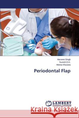 Periodontal Flap Singh Harveen                            D. K. Suresh                             Khurana Heena 9783659126635 LAP Lambert Academic Publishing - książka