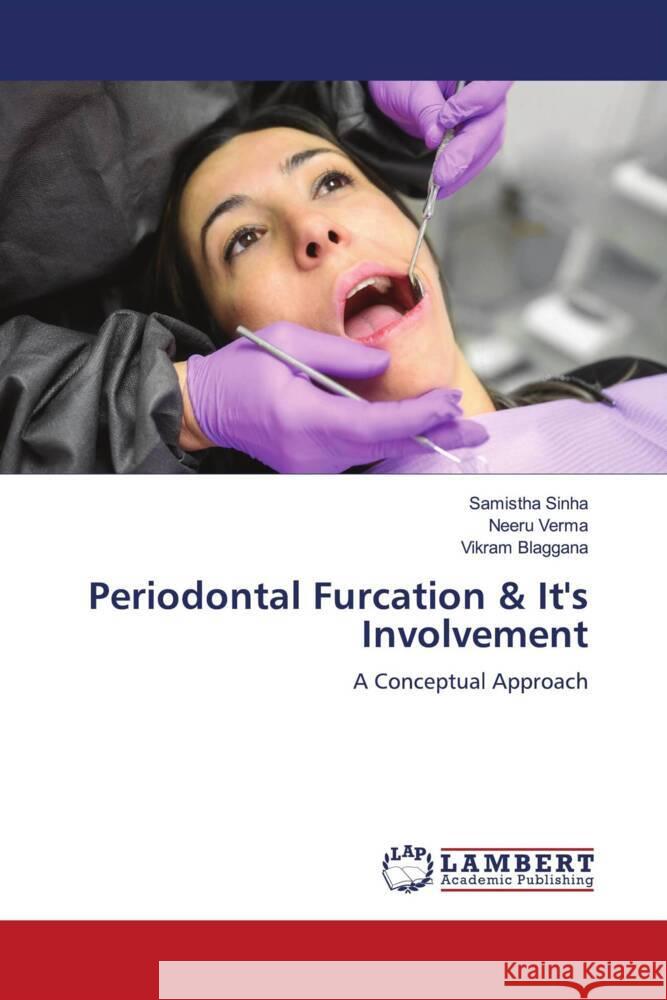 Periodontal Furcation & It's Involvement Sinha, Samistha, Verma, Neeru, Blaggana, Vikram 9786206783602 LAP Lambert Academic Publishing - książka