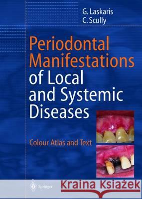 Periodontal Manifestations of Local and Systemic Diseases: Colour Atlas and Text Laskaris, George 9783642627880  - książka